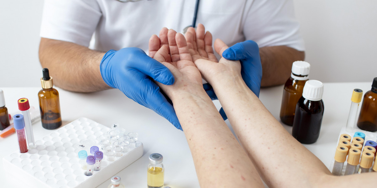 Urticaria Specialists Explain: What Really Causes Hives and How to Treat Them Effectively