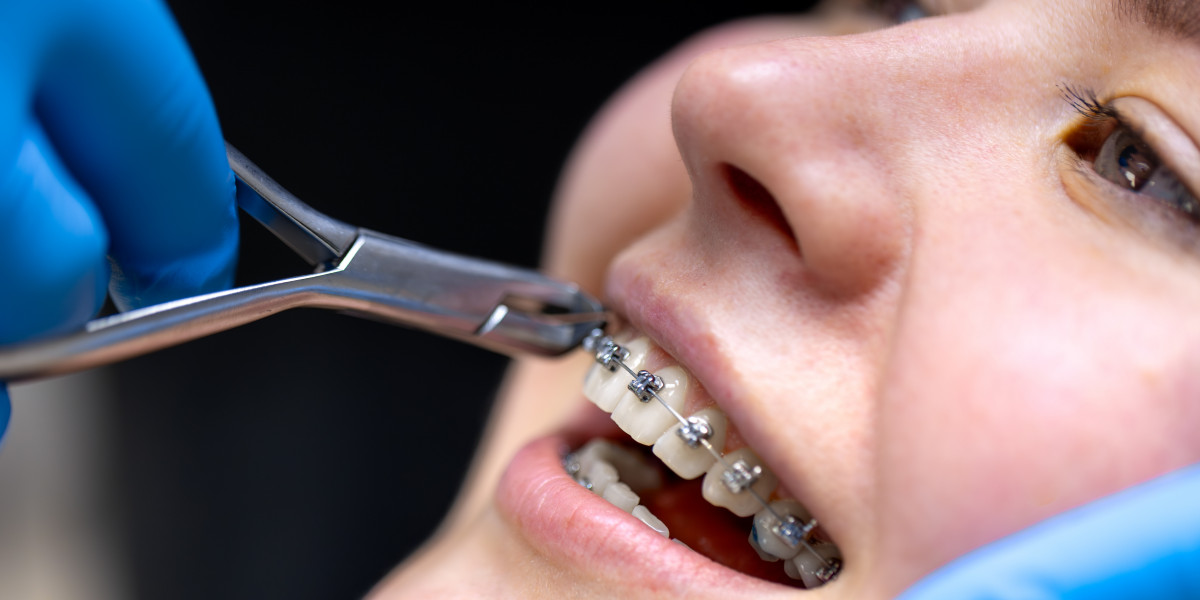 Is Your Child Ready for Invisalign Braces? Signs Parents Should Look For