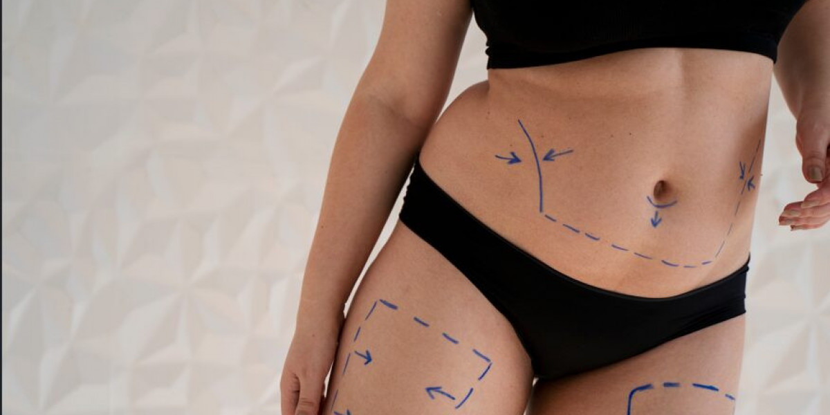 How Lipo Abdominoplasty Targets Fat and Loose Skin Simultaneously