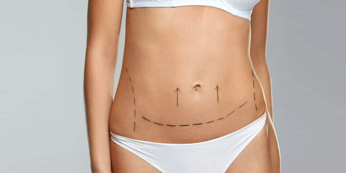 Achieving Natural Results with Lipo Abdominoplasty