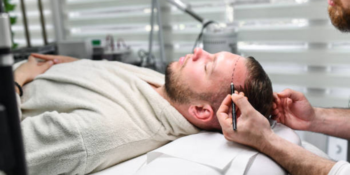 The Science of Hair Follicle Extraction and Implantation